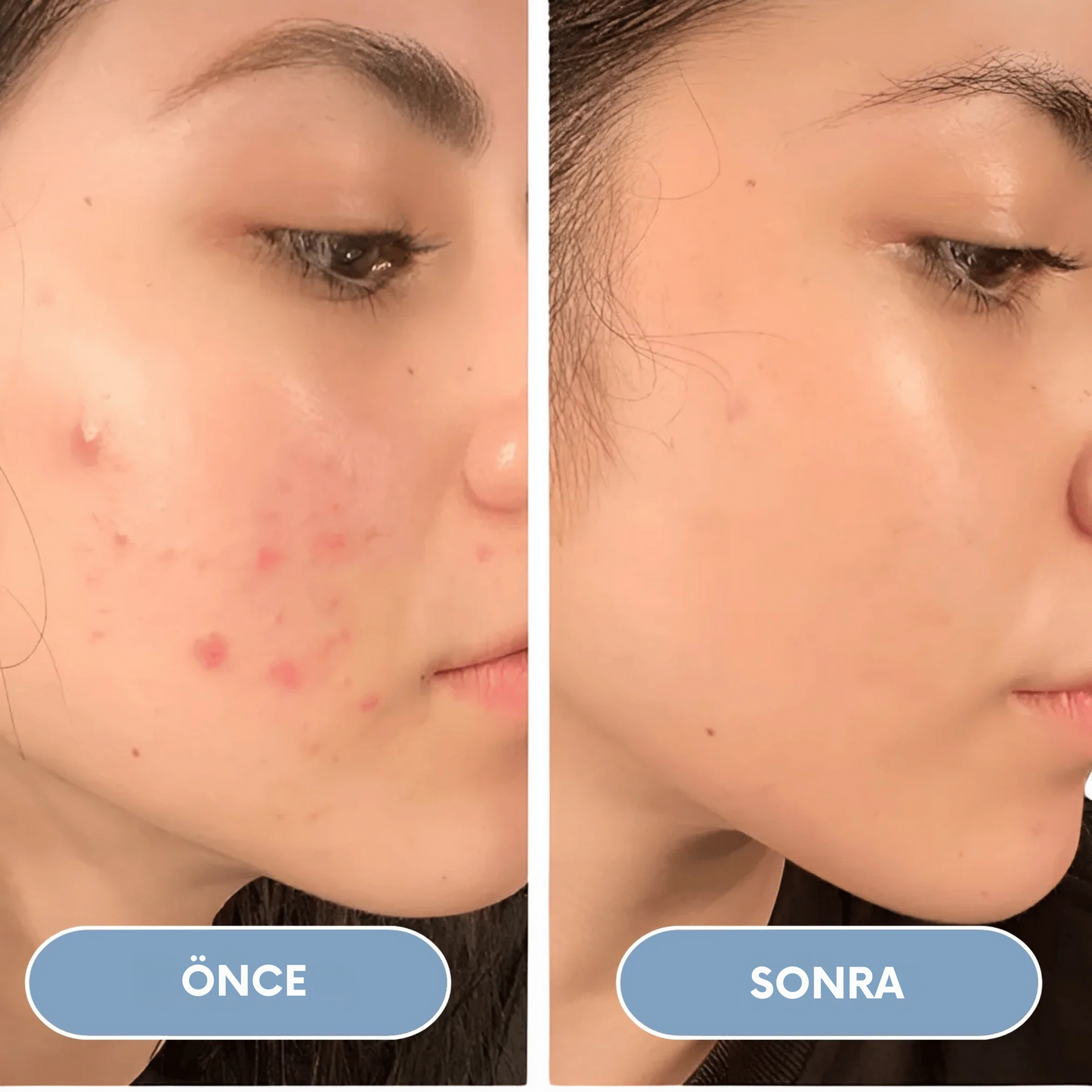 Orvado Plus Filtreli Duş Başlığı